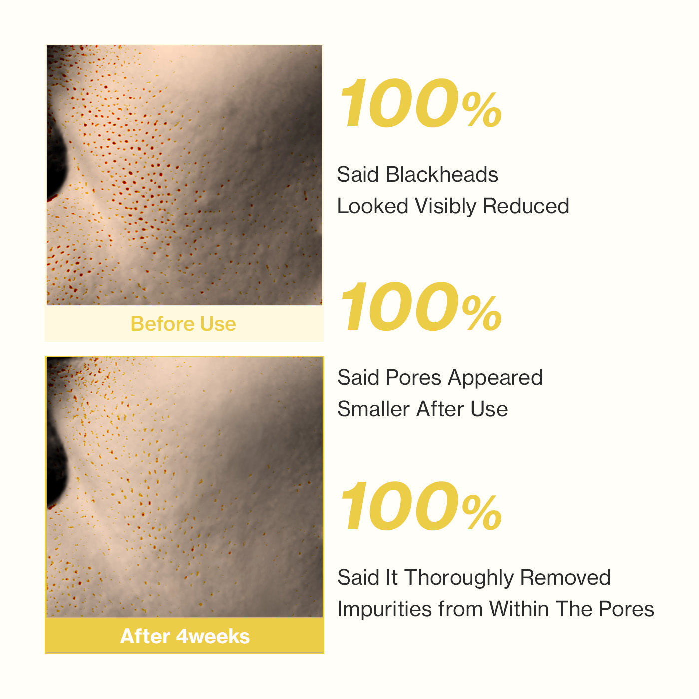 YUMU Coix Pore Control Deep Pore Cleansing Oil