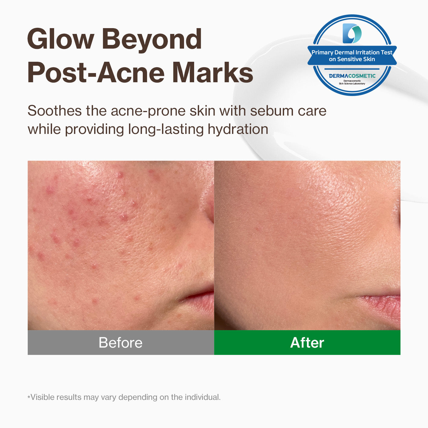 YUMU Cica Exosome Blemish Relief Cream