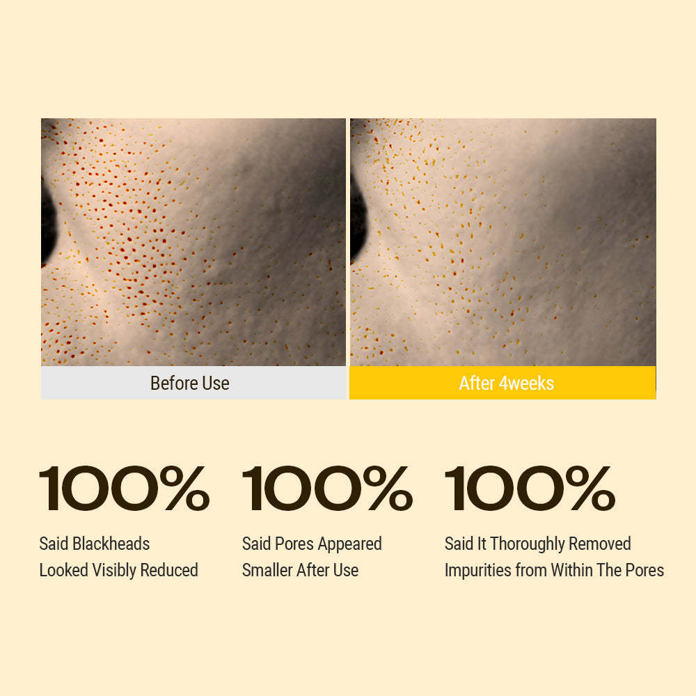 YUMU Coix Pore Control Deep Pore Cleansing Oil